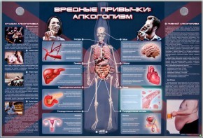 Электрифицированный стенд "Вредные привычки: алкоголизм" - fgospostavki.ru - Домодедово